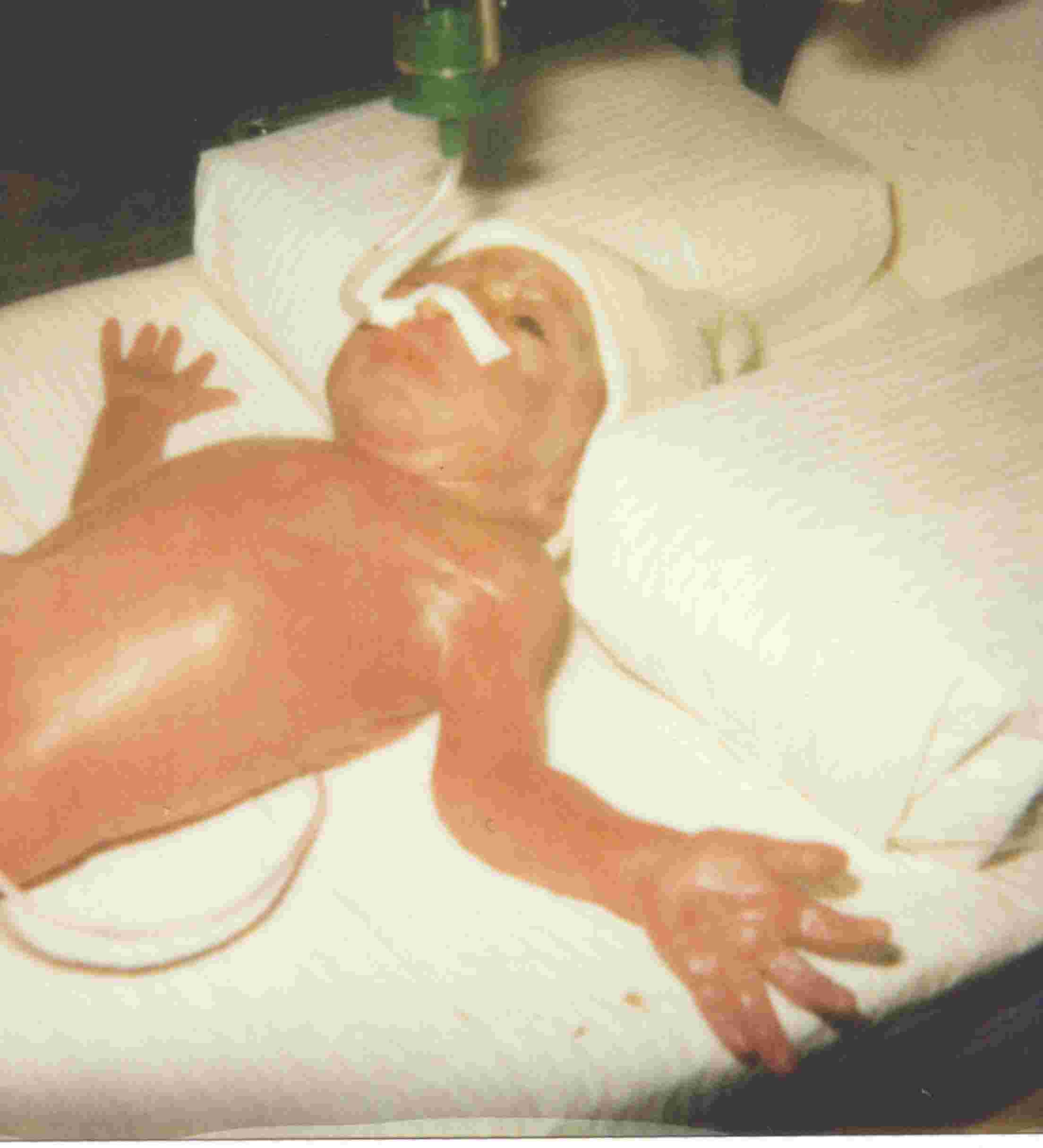 Alice 26/10/98 (polaro&iuml;d pris par la sage-femme)